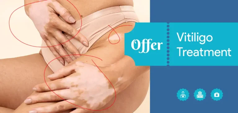 FREE CONSULTATION