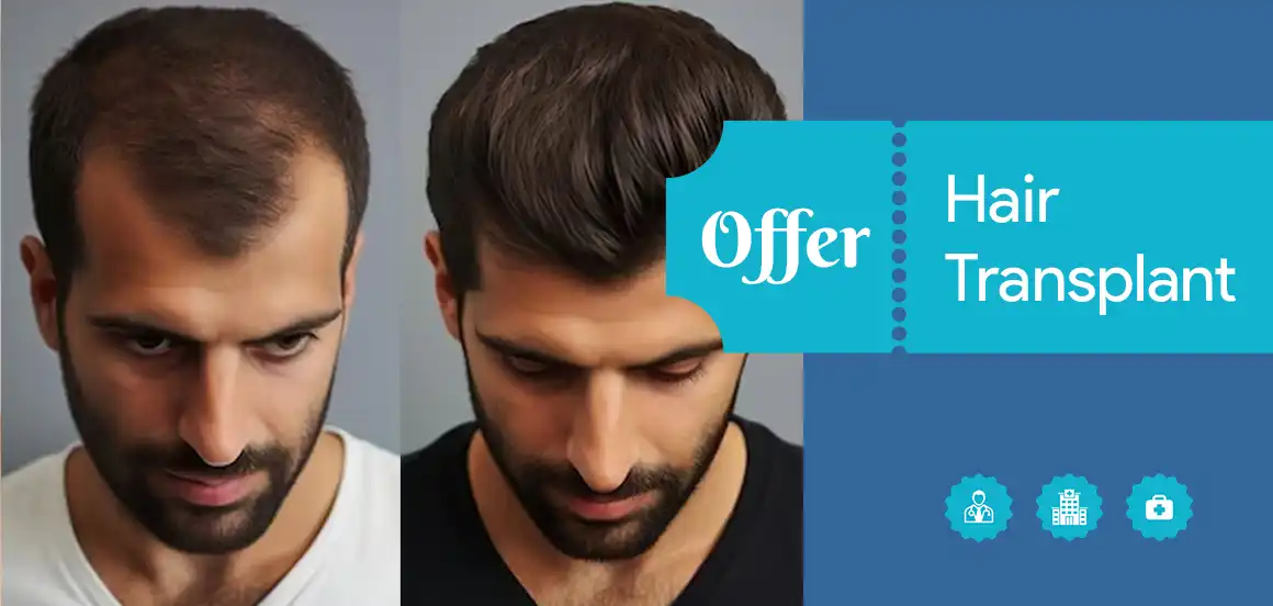 hair transplant